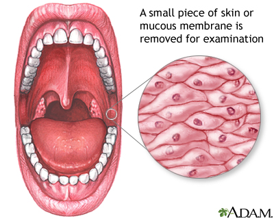 Mucosal biopsy