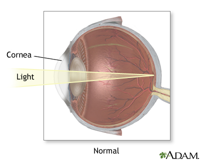 Normal vision