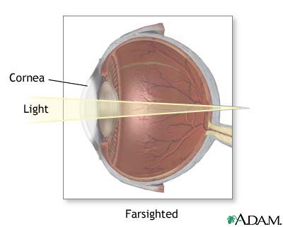 Farsighted