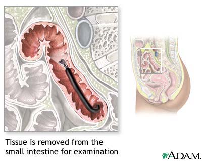 Small intestine tissue sample