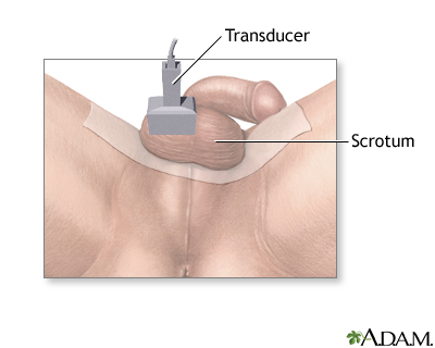 Tesitcular ultrasound