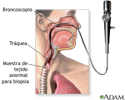 Examen de las vías respiratorias superiores