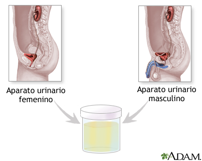 Examen de orina