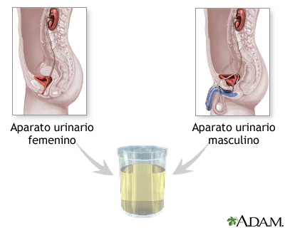 Muestra de orina