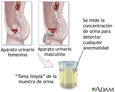 Prueba de concentración de orina