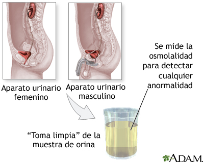 Prueba de osmolalidad