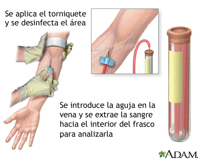 Examen de sangre