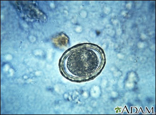 Huevos de oxiuros: ascariosis