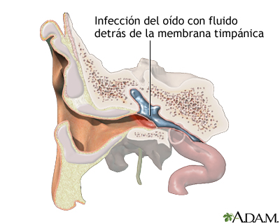 Indicaciones