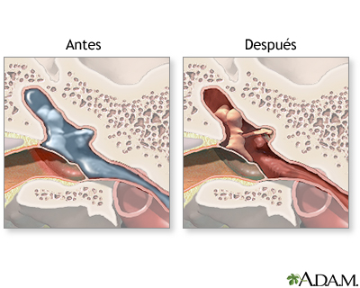 Cuidados postoperatorios