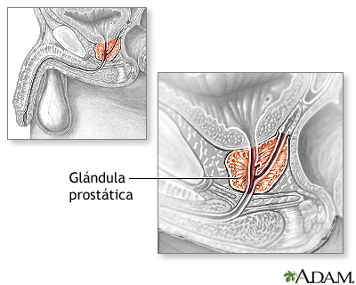 Anatomía normal