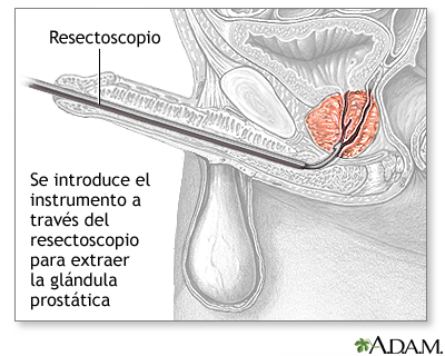 Procedimiento