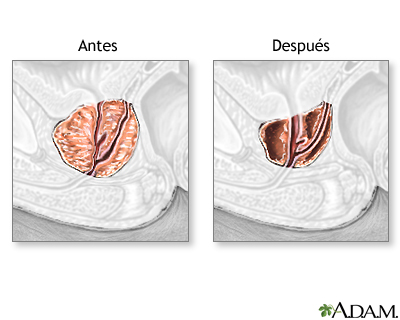 Cuidados postoperatorios