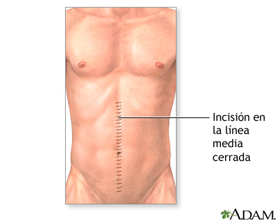 Cuidados postoperatorios