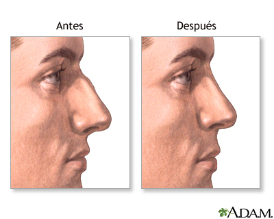 Cuidados postoperatorios