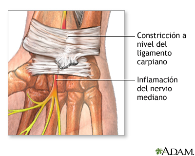 Indicaciones