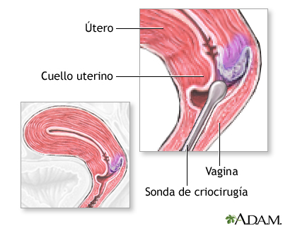 Procedimiento (primera parte)