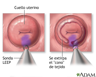 Procedimiento (segunda parte)