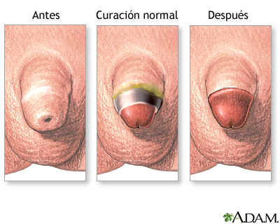 Cuidados postoperatorios