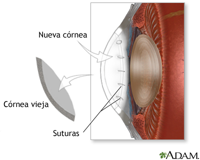 Procedimiento