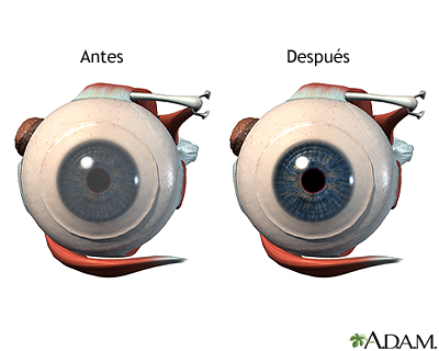 Cuidados postoperatorios