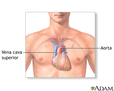 Anatomía normal