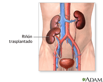 Cuidados postoperatorios