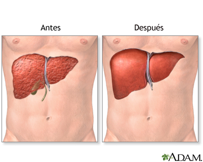 Cuidados postoperatorios