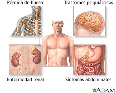 Indicaciones