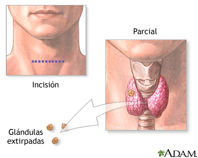 Procedimiento