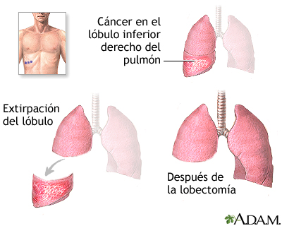 Procedimiento