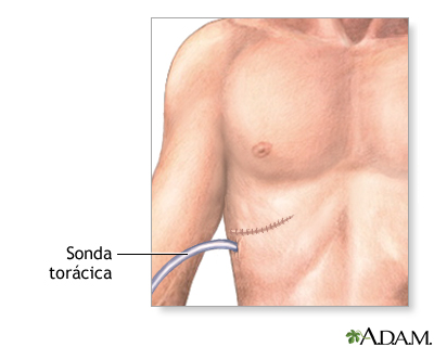 Cuidados postoperatorios