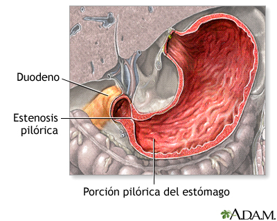 Indicaciones