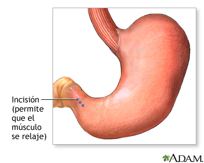 Procedimiento