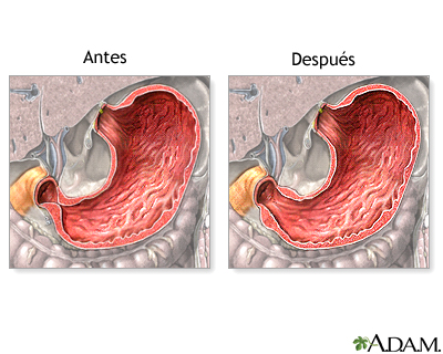 Cuidados postoperatorios