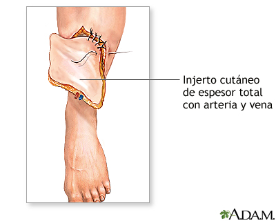 Procedimiento