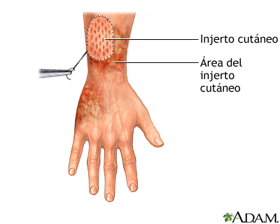 Procedimiento