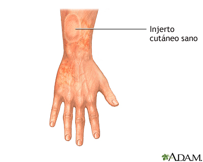 Cuidados postoperatorios