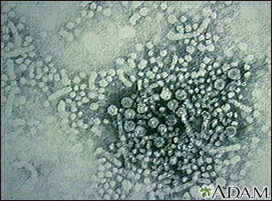 Virus de hepatitis B