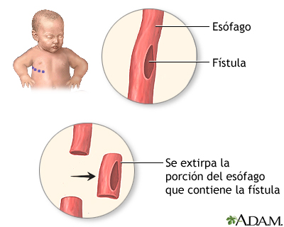 Procedimiento (primera parte)