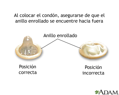 Procedimiento (primera parte)