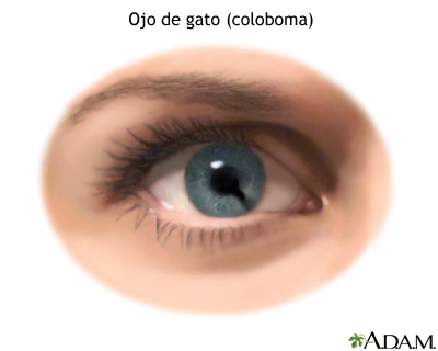 Ojo de gato