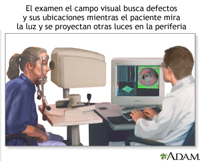 Examen del campo visual