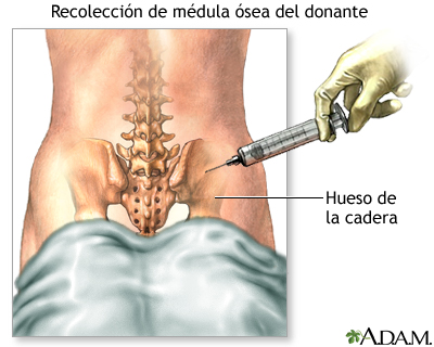 Procedimiento