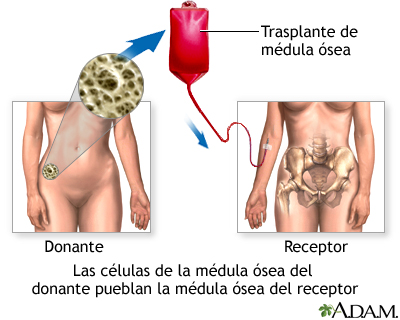 Cuidados postoperatorios