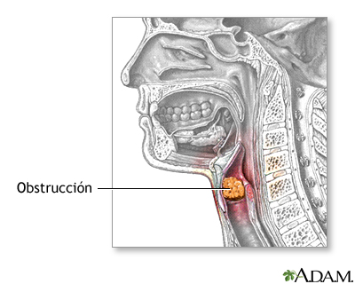 Indicaciones