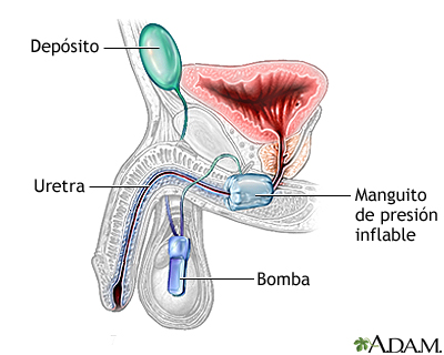 Procedimiento (segunda parte)