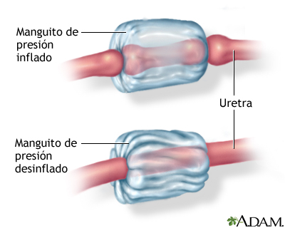 Procedimiento (tercera parte)