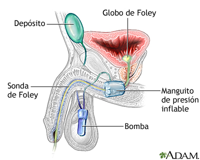 Cuidados postoperatorios