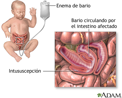 Indicaciones (segunda parte)